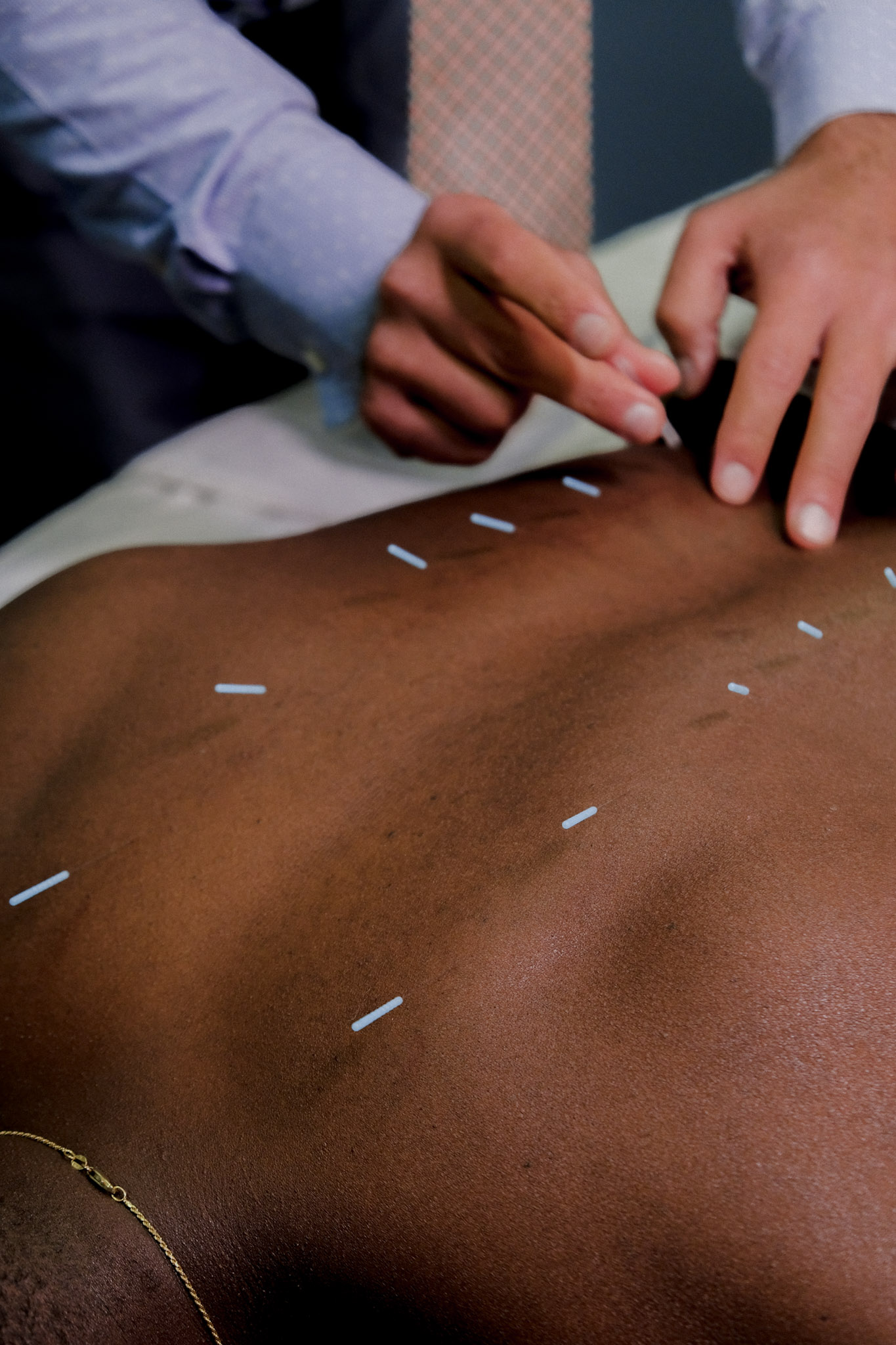 Harnessing the Power of Traditional Chinese Medicine Techniques for Pain Treatment